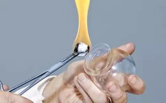 拔罐治療內(nèi)風濕的一些注意事項