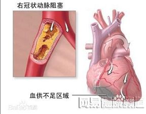 擴(kuò)張,注意事項(xiàng),心臟