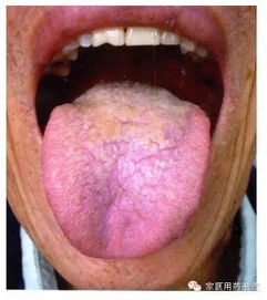 舌診的基礎(chǔ)知識(shí)