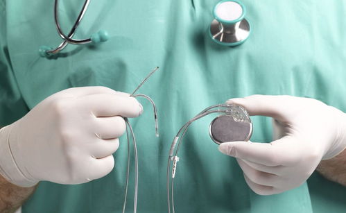 起搏器,基礎知識,概述,心臟