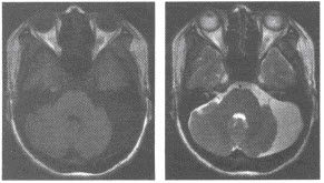 mri檢查基礎知識