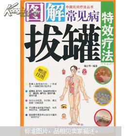 拔罐療法基礎(chǔ)知識