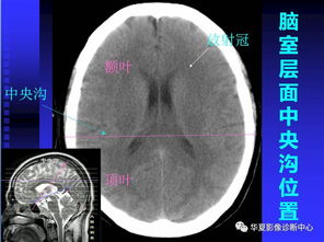 MRI線圈基礎(chǔ)知識及維修技巧