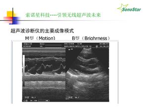學(xué)b超基礎(chǔ)知識(shí)
