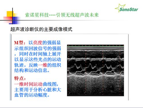b超基礎(chǔ)知識麻醉科